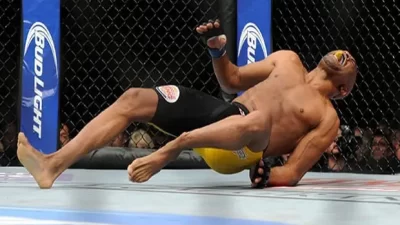 Ini Dia 5 Luka Paling Mengerikan yang Pernah Terjadi di UFC