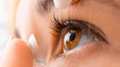 Mengapa Wanita Ini Menyimpan 27 Lensa Kontak di Mata? Dokter Kaget dengan Temuan Tak Terduga Ini!