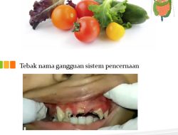 Ketahui bahaya gangguan pencernaan