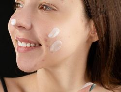 Mengapa Niacinamide Malah Sebabkan Jerawat? Ini 6 Alasannya