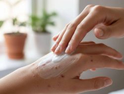 7 cara menghilangkan bekas cacar untuk ibu hamil