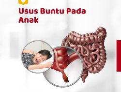 Waspadai Usus Buntu pada Anak, Dokter Spesialis Bedah Jelaskan Tanda dan Bahayanya